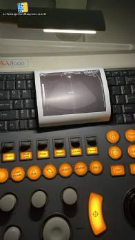 Dispositivo de ultrasonido para cl�nicas m�dicas Medison Sansung